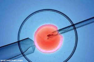 试管借卵代怀机构